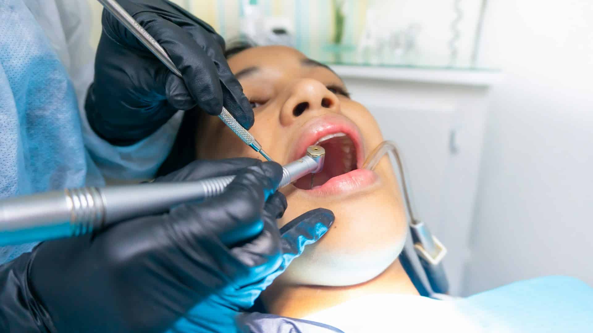 emergency tooth extraction