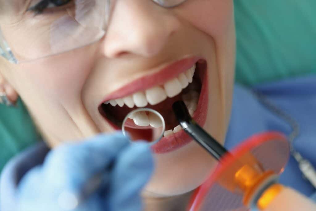 cosmetic-bonding-for-chipped-front-teeth